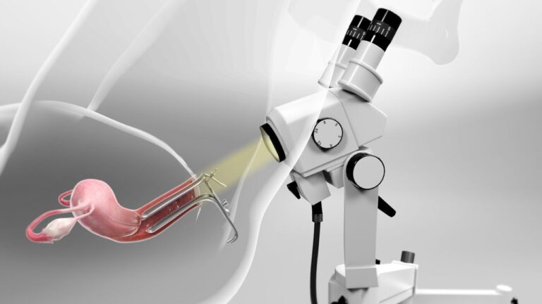 colposcopy